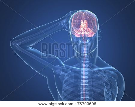 headache illustration