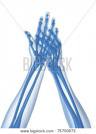 x-ray hands - arthritis