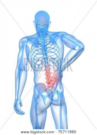 backache illustration