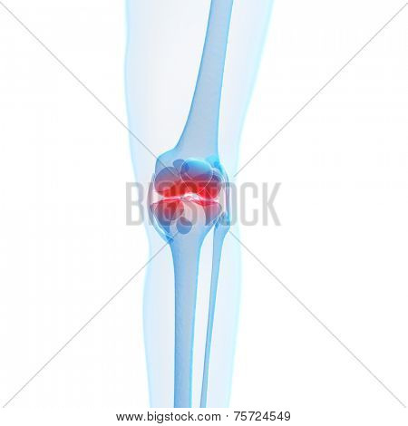 3d rendered illustration of a painful knee