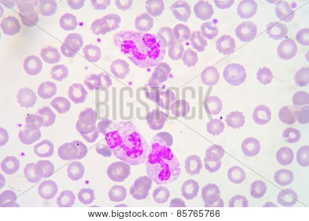 Neutrophils Are A Type Of Phagocyte And Are Normally Found In The Bloodstream.