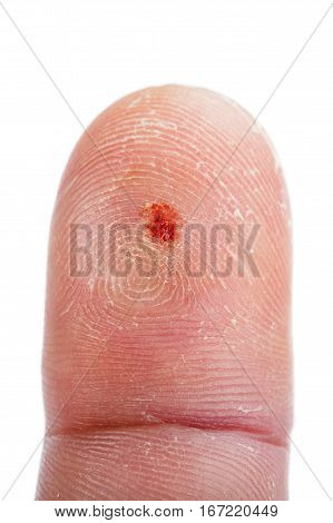 Close up photo of injured fingertip on isolated white background