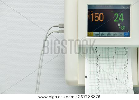 Monitor For Measuring Contractions, Heartbeat Of A Pregnant Woman