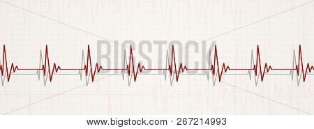 Normal Heart Beats Illustration