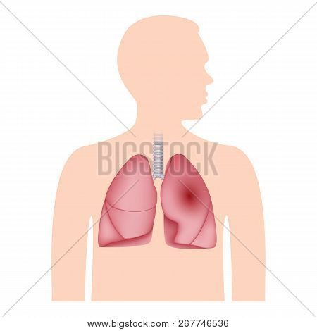 Human Lungs Icon. Realistic Illustration Of Human Lungs Icon For Web Design Isolated On White Backgr