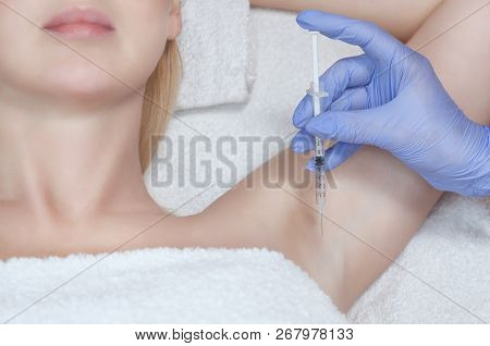 The Doctor Makes Intramuscular Injections Of Botulinum Toxin In The Underarm Area Against Hyperhidro