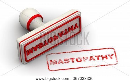 Mastopathy. The Seal. The White Seal And Red Imprint Mastopathy (it Is Fibrocystic Breast Changes) O