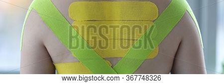 Female Wearing Kinesio Tapes At Her Back And Shoulders At Doctor Office Closeup