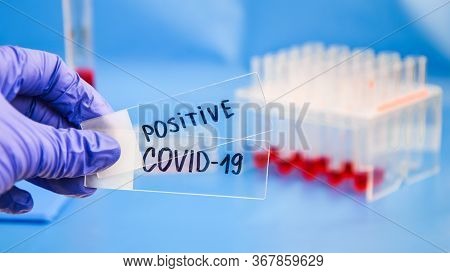 Close Up Of Microbiologist Hand With Surgical Gloves Holding A Positive Blood Test Result For Corona