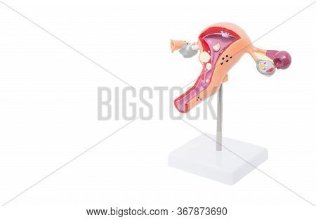 Mock Reproductive Female System On A White Background. The Concept Of Female Diseases In Gynecology,
