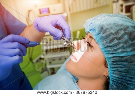 Laser Vaporization Of Nasal Concha With Coblation Technology Method
