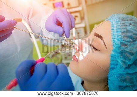 Endoscopic Sinus Surgery. Laser Vaporization Of Nasal Concha
