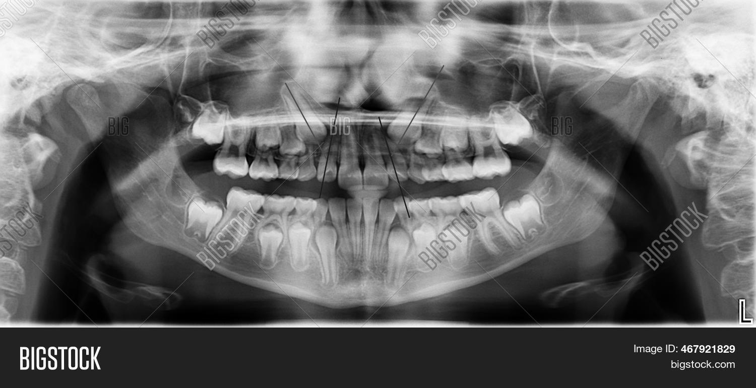 Dentist Xray Little Image & Photo (Free Trial) Bigstock