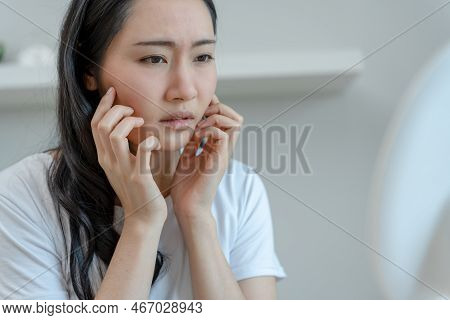 Woman Worried About Face Dermatology, Rosacea Dermatitis, Allergic Steroids, Sensitive Skin, Red Fac