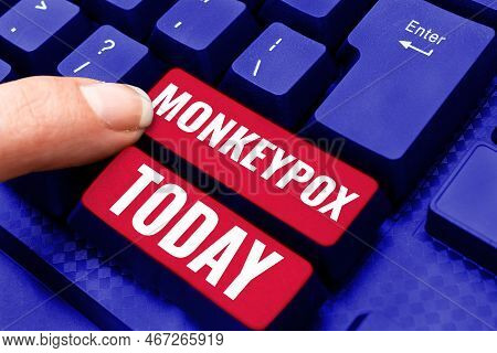 Text Sign Showing Monkeypox. Conceptual Photo Poxvirus Of Africa Caused By Chiefly In Wild Rodents A
