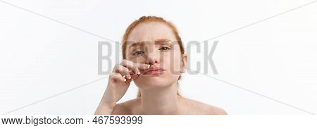 Young Caucsian Woman Squeezes Acne On The Face Of Beauty