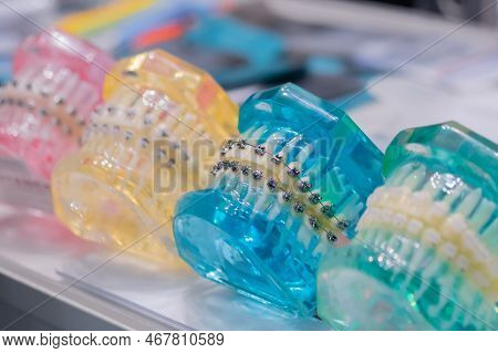 Transparent Colorful Human Jaws With Orthodontic Bracket, Metal And Ceramic Braces. Stomatology, Edu