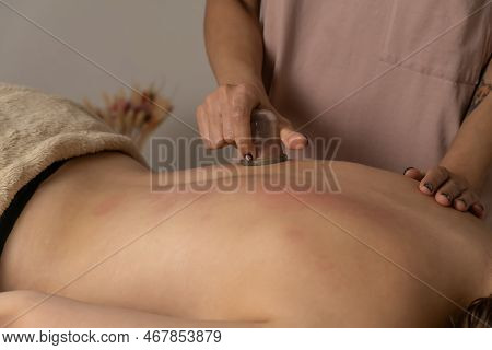 Massage Therapist At The Spa Does A Massage With A Vacuum Jar On The Back Of His Client For A Healin