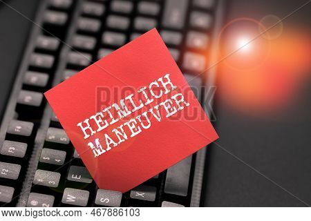 Conceptual Display Heimlich Maneuver. Business Approach Application Of Upward Pressure In Case Of Ch