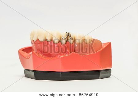 Dental Dentures Isolated On White