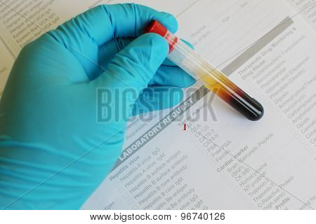 AFP testing
