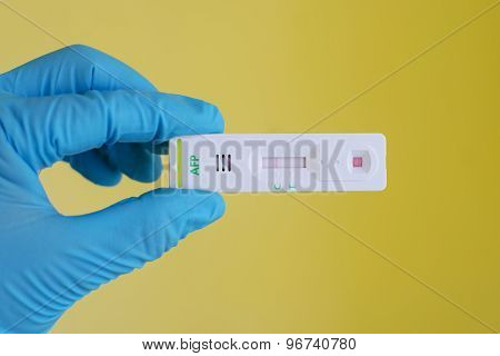 AFP negative