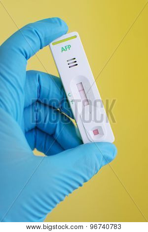 AFP negative