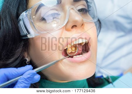 Dental patient and concave mirror. Teeth of young woman.