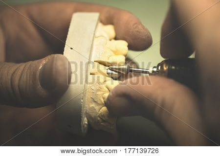 Dental prosthesis artificial tooth prosthetic hands working on the denture false teeth.