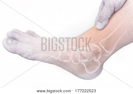 foot muscle pain white background foot injury