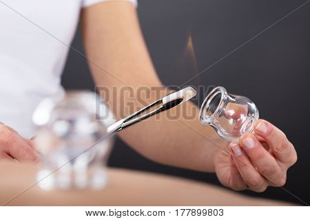 Close-up Of A Therapist Giving Cupping Treatment At Beauty Spa