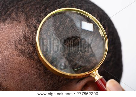 Man's Hair Seen Through Magnifying Glass