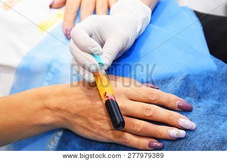 Plasmolifting. Injections For Rejuvenation And Skin Regurgitation From Human Plasma. A Modern Beauty