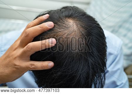 Bald In The Middle Head And Begin No Loss Hair Glabrous Of Mature Asian Business Smart Active Office