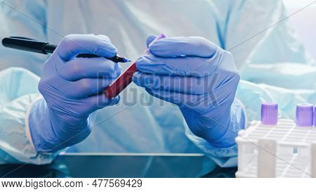 Blood Research. Medical Laboratory. Virus Test. Technician Hands In Rubber Protective Gloves Marking