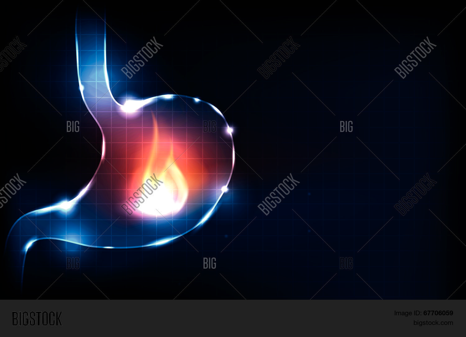Image Preview