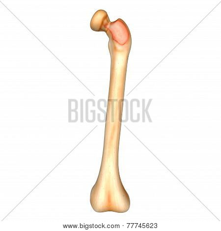 Bone