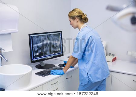 Female nurse examining x-ray report on computer in clinic