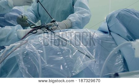 Laparoscopic surgery of the abdomen. The team of medical specialists conducting laparoscopic surgery.