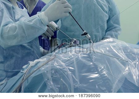 Laparoscopic surgery of the abdomen. The team of medical specialists conducting laparoscopic surgery.