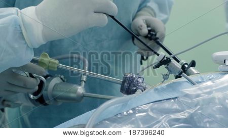 Laparoscopic surgery of the abdomen. The team of medical specialists conducting laparoscopic surgery.