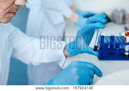Look attentively. Serious medical worker looking at blood in test-tube and pressing lips while going to test this exemplar