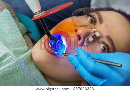 Dentistry At Dentist. Young Girl In Protective Glasses With Open Mouth. White Teeth. Dentist Works W