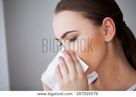 Flu And Sick Woman. Sick Woman Using Paper Tissue, Head Cold Problem