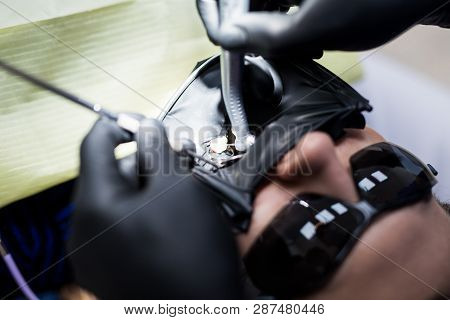 Modern Dental Equipment. Dentist Treats Tooth Decay In The Teeth With A Dental Drill, Saliva Ejector