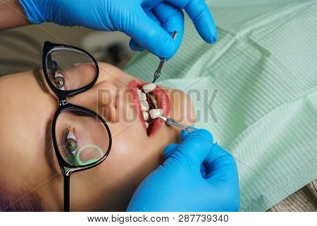 Teeth Whitening At Dentist. Young Woman Showing Teeth. White Teeth. Dentist Picks Up Shade Of Enamel