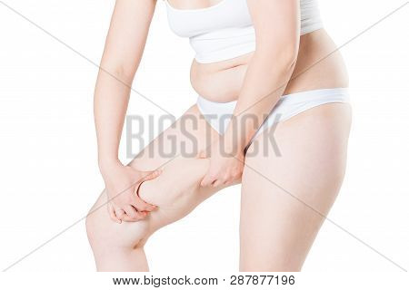 Overweight Woman With Fat Thighs, Obesity Female Legs Isolated On White Background, Weight Loss Conc