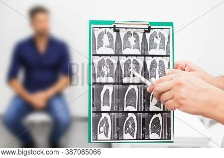 Pulmonologist Showing Ct Scan Of Lungs Patient With Pulmonary Fibrosis, After Recovery, Lung Disease