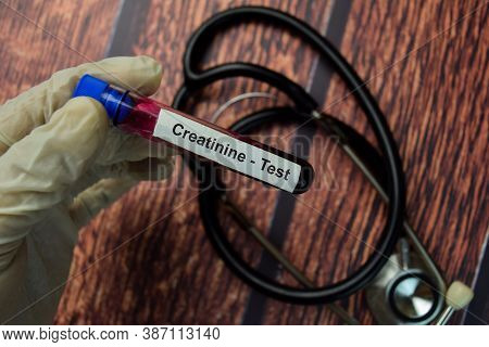 Creatinine - Test With Blood Sample. Top View Isolated On Black Background. Healthcare/medical Conce