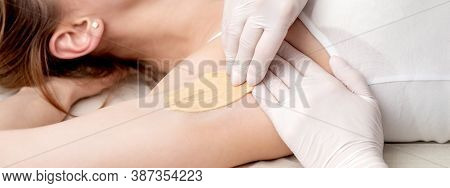 Hand Of Cosmetologist Applying Wax Paste On Armpit. Depilation Or Epilation Female Armpit With Liqui